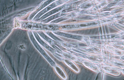 Thallus of Genistellospora homothallica bearing trichospores